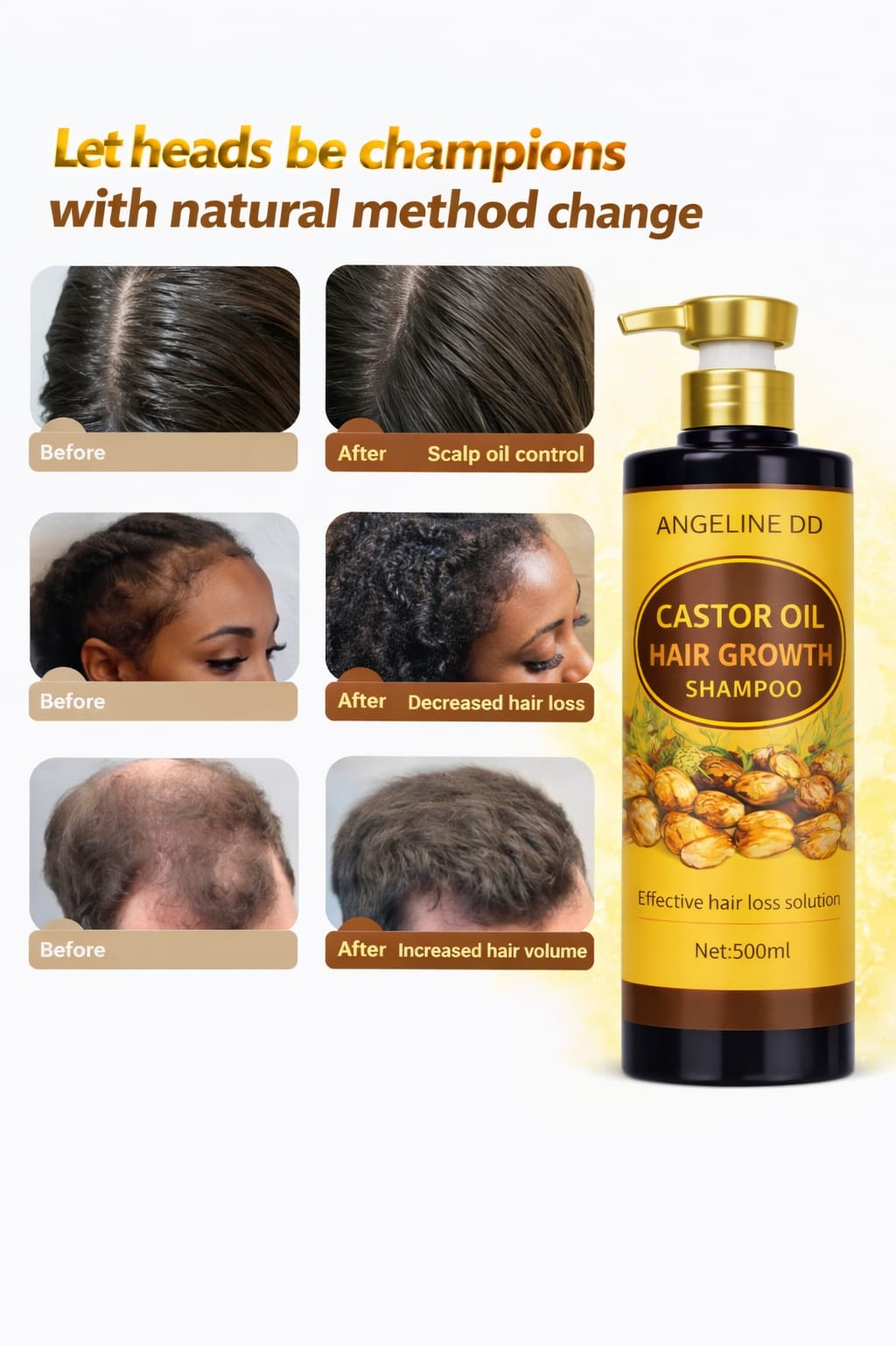 Castor Oil Hair Growth Shampoo